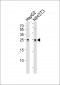 PTHLH Antibody (N-term)